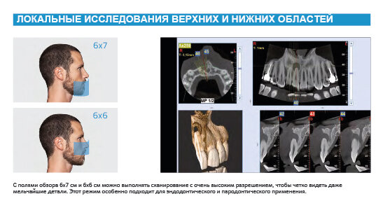 ЛОКАЛЬНЫЕ ИССЛЕДОВАНИЯ ВЕРХНИХ И НИЖНИХ ОБЛАСТЕЙ